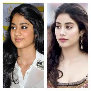 janhvi kapoor before after plastic surgery