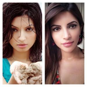 Shama Sikander Before After Plastic Surgery Makeover