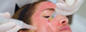 prp skin treatment in mumbai, prp treatment in mumbai