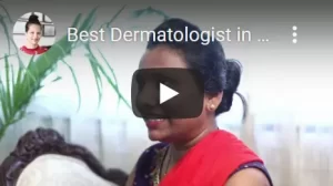 Best Dermatologist Review in Mumbai, Pigmentation Treatment
