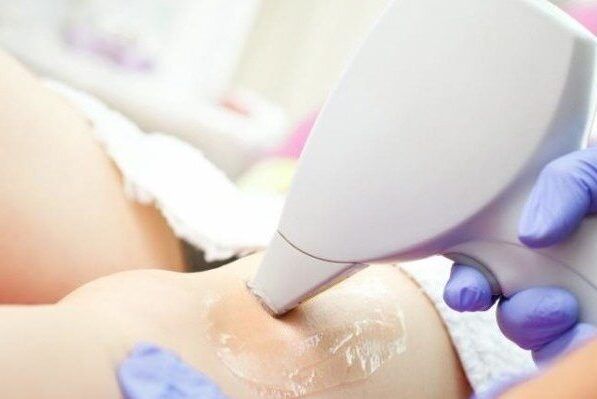 Full Body Laser Hair Removal in Mumbai, Best Laser Hair Removal Clinic in Mumbai