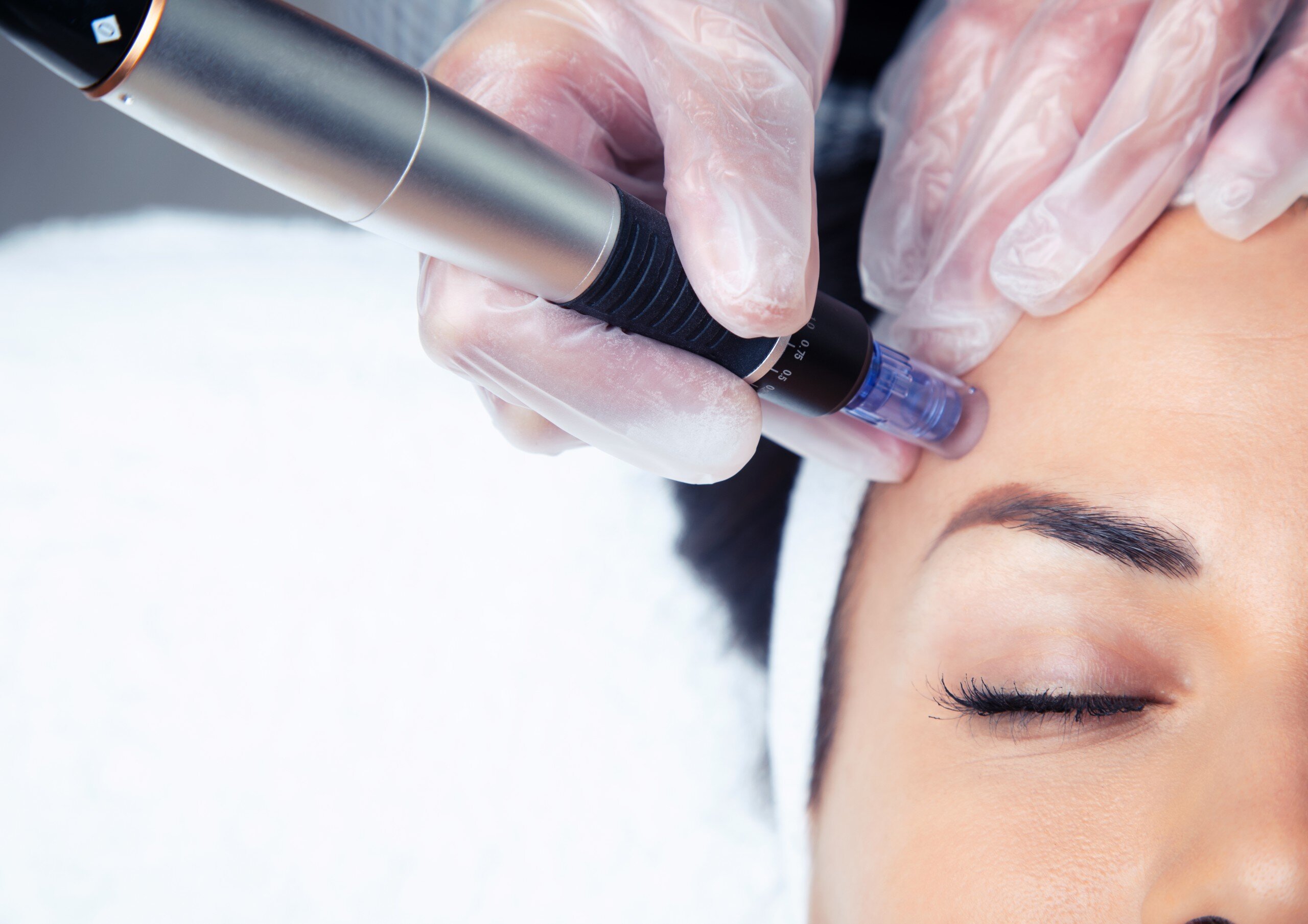 Microneedling Treatment in Mumbai - Best Derma Pen Facial