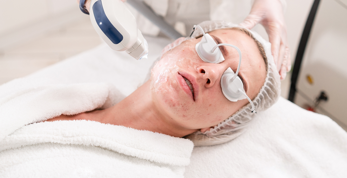 laser pimple scar removal in mumbai with Dr. Niketa Sonavane, top dermatologist at Ambrosia Aesthetics Mumbai, pimple scar laser treatment, laser treatment for pimple scars, laser pimple scar removal cost,