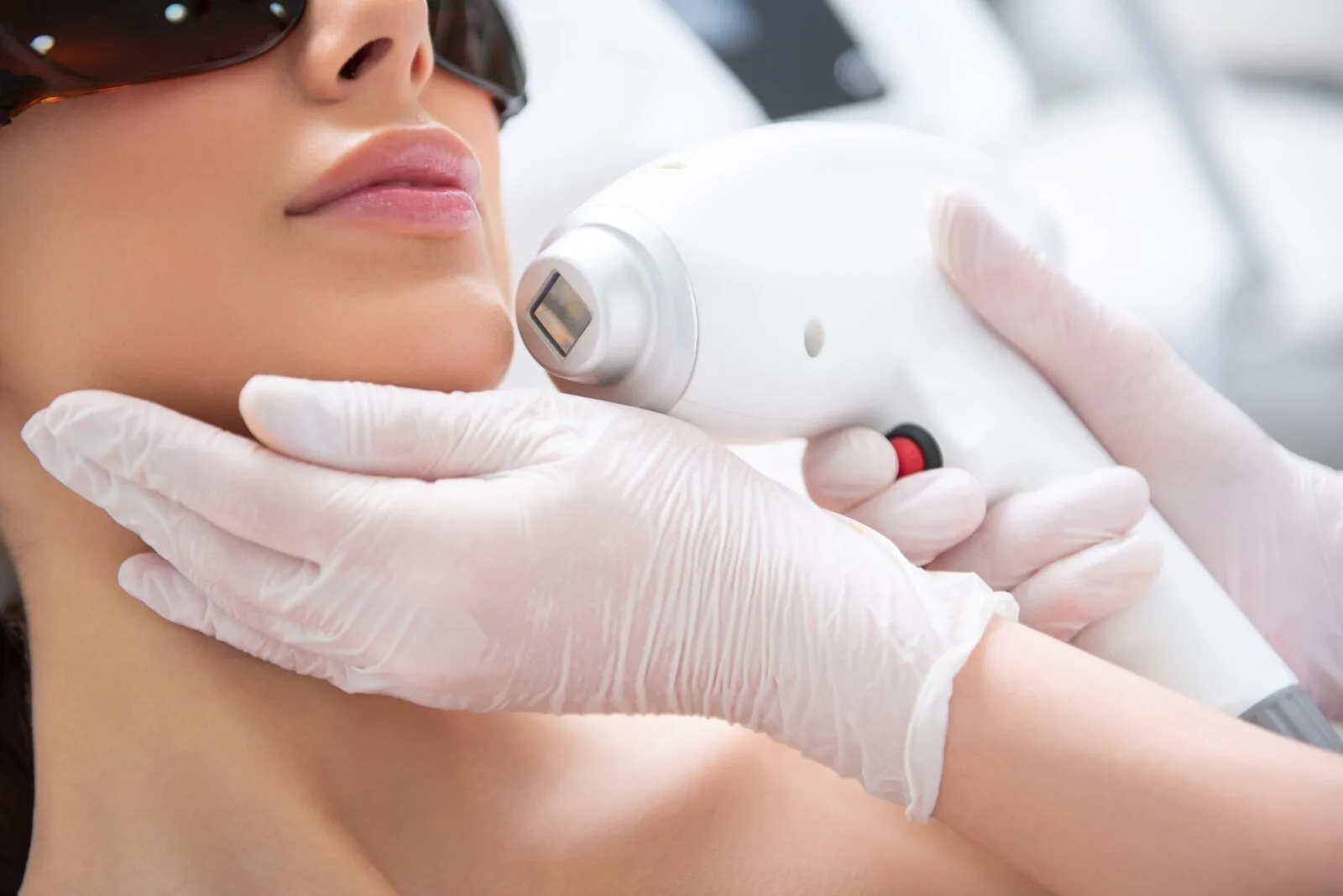 laser treatment for face, laser pimple scar removal, carbon laser facial, laser hyperpigmentation treatment, laser skin lightening, intense pulse light photofacial with Dr. Niketa Sonavane, Best dermatologist in Mumbai, Ambrosia Aesthetics, laser skin treatment,